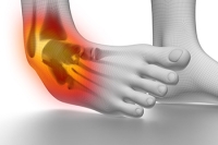 Ankle Injuries and Grades